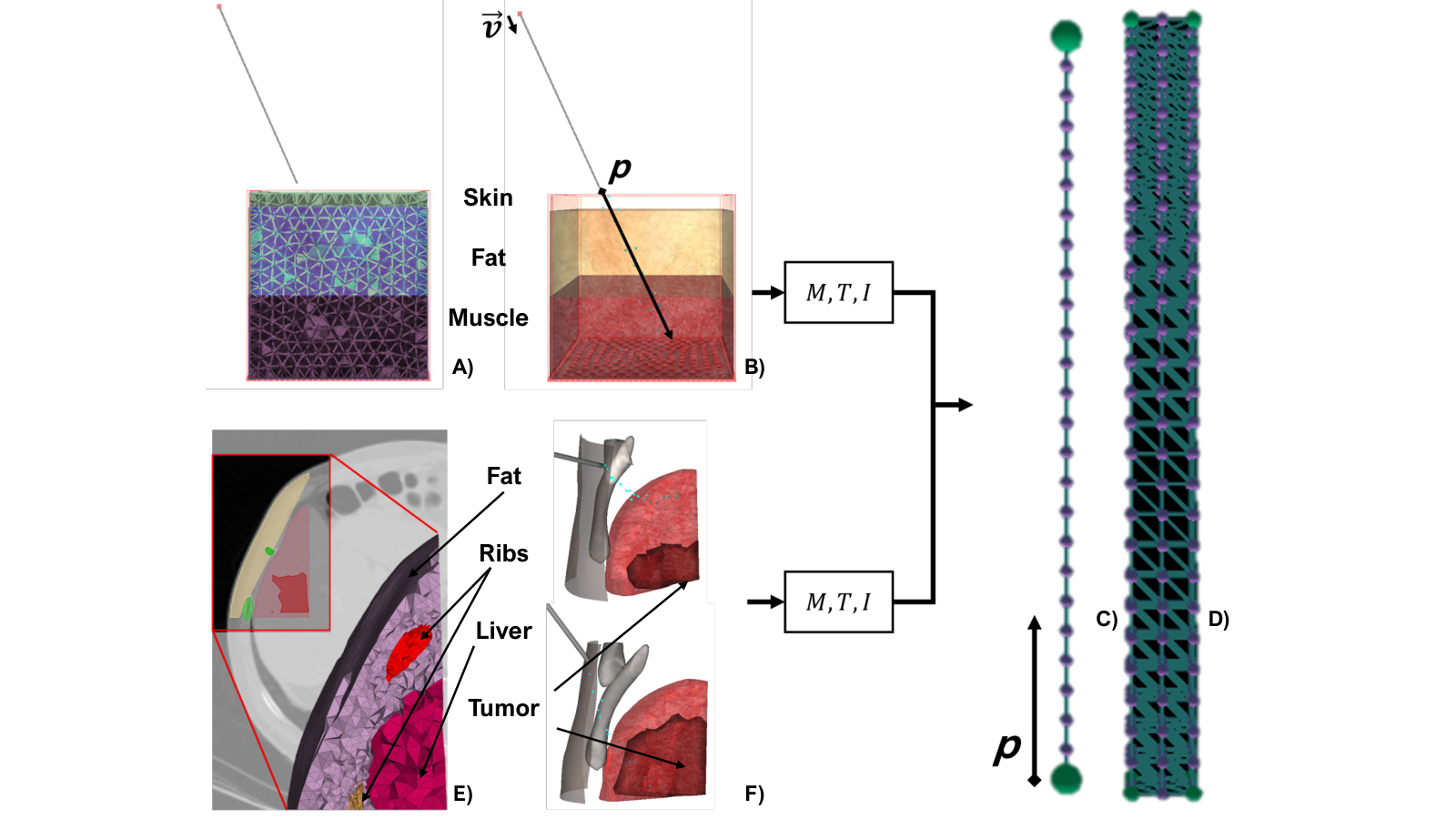 BioSonix framework connecting anatomy, tissue deformation and physics-based sonification