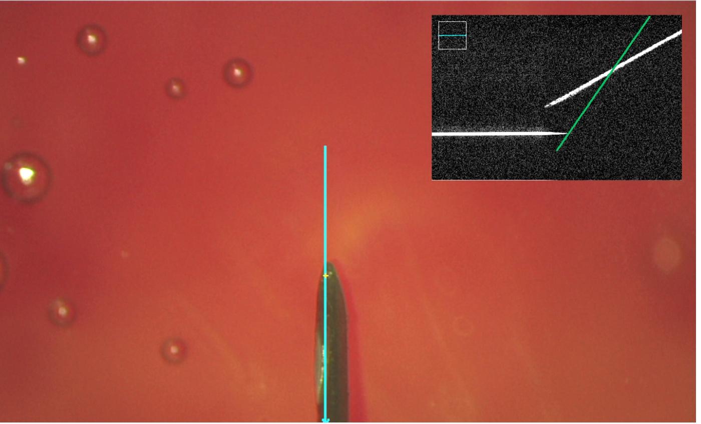 SonifEye experimental microscopic view with needle and OCT overlay